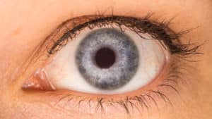 Névrite optique