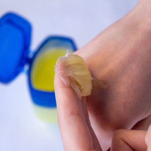 La vaseline