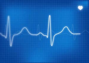 électrocardiographe
